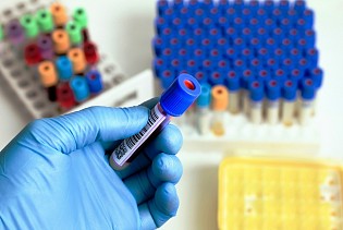 Quản lý mẫu xét nghiệm máu bằng công nghệ mã vạch